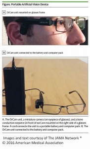 Orcam Unit