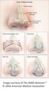 Review Article Compared Over-the-counter Nasal Dilators - For The Media 